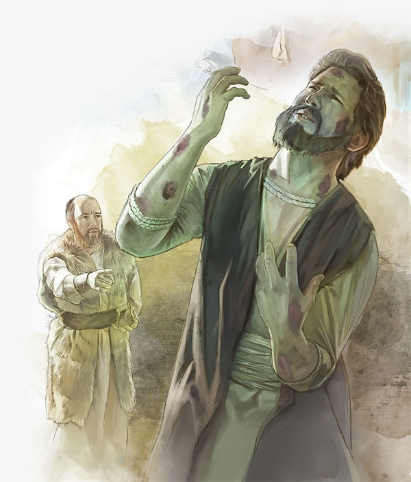 Gehazi with leprosy
