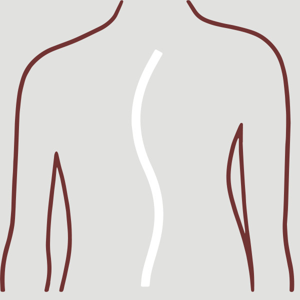 Setšoantšo sa lesapo la mokokotlo le kobehileng