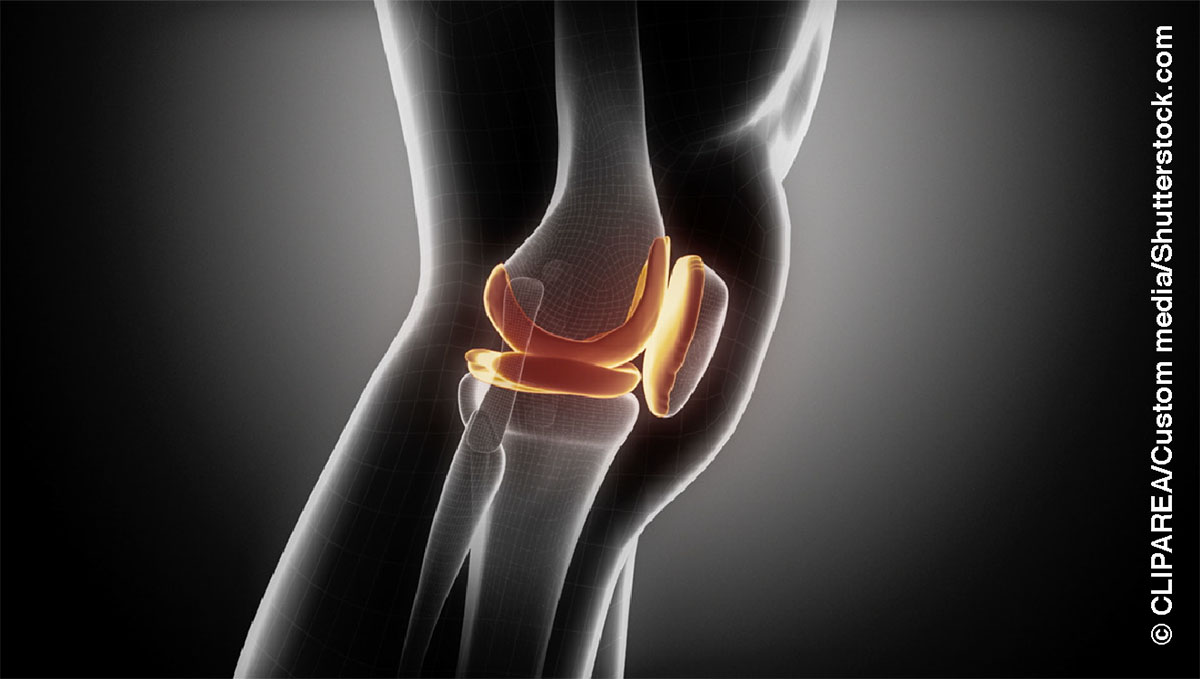 La strutura del denòcio.